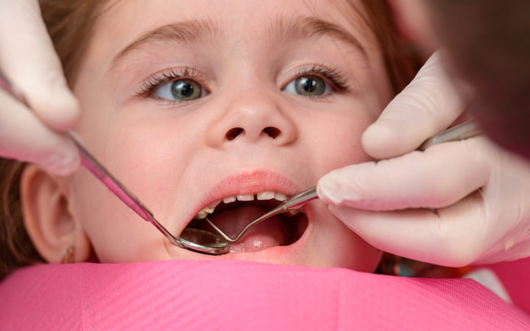 Cavities in Kids: To Pull or To Fill?